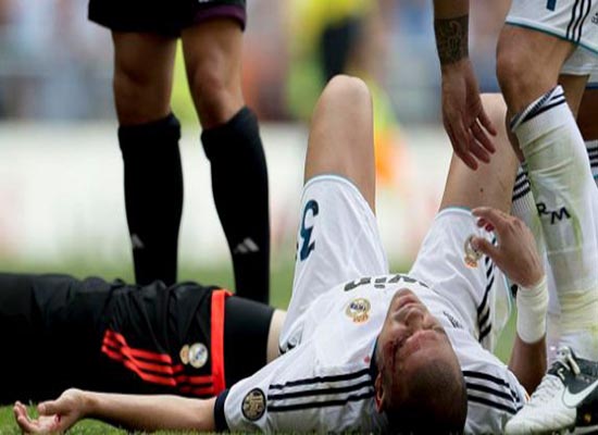 الإصابة تبعد "بيبي" عن ديربي مدريد والكلاسيكو