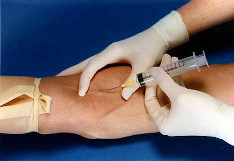 دمه النادر ينقذ مليوني طفل