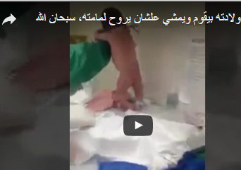 شاهد.. طفل بعد ولادته يمشي ليذهب لأمه .. سبحان الله