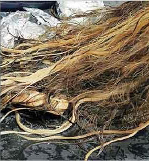 "صبغة" تتسبب في حرق فروة رأس فتاة وتساقط شعرها