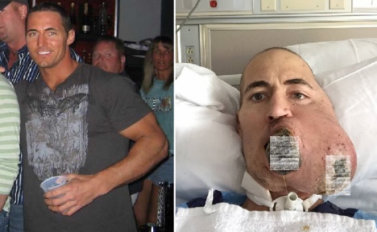 ما حدث لهذا الرجل رهيب جدا .. رغم أنه لا يشعر إلا بألم بسيط جدا !