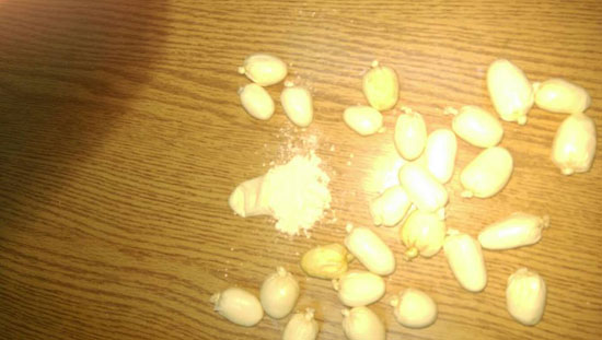 بالصور : ضبط عربي يحمل المواد المخدرة في احشائه في مطار عمان