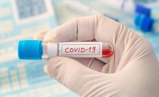 سحب 100 عينة عشوائية من موظفي جمارك العقبة