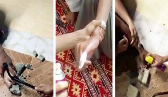 "المطرقة" و"مبيد الحشرات" أسلحة الشباب لنيل إجازات مرضية!!
