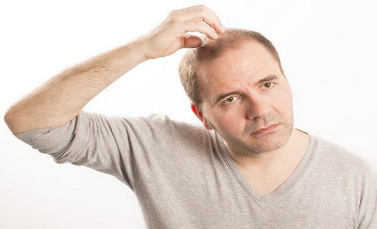 علاج تساقط الشعر عند الرجال