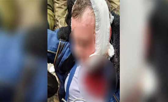 لقطات لـ "أسر طيار روسي" بعد إسقاط طائرته في أوكرانيا .. بالفيديو لقطات لـ "أسر طيار روسي" بعد إسقاط طائرته في أوكرانيا .. بالفيديو