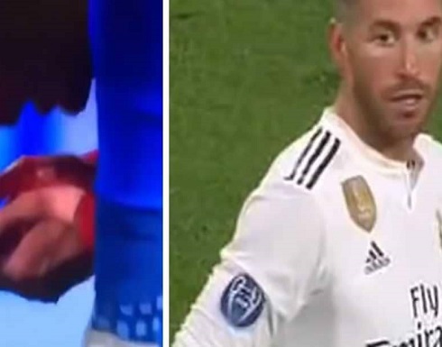 بالصورة : راموس يسيل دماء خصمه.. وتنديد بالحركة "القذرة"