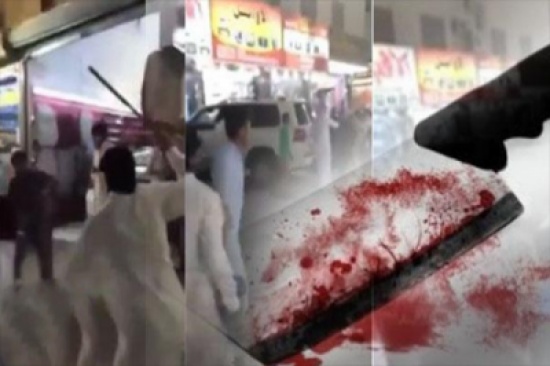 شاب يضرب آخر بالساطور على رأسه صارخًا: ”اعتدى على محارمي“ شاب يضرب آخر بالساطور على رأسه صارخًا: ”اعتدى على محارمي“