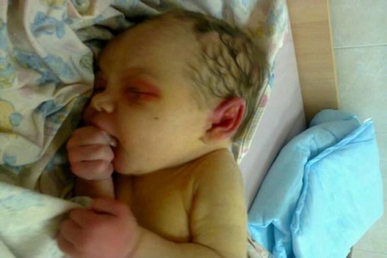 رضيع كان مدفوناً في الغابات وأكله النمل.. ستصدمون عندما ترون شكله اليوم!