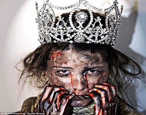 ملكة جمال الكون بوجه دامي