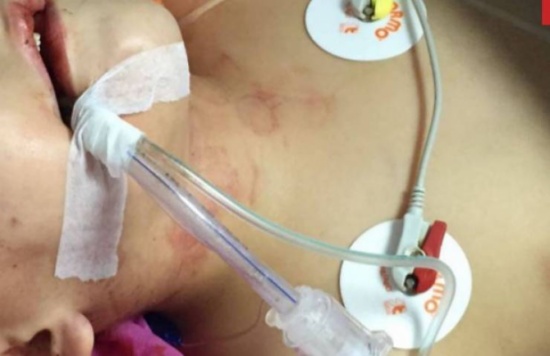 عاملة منزلية حاولت قتل هذا وحالته حرجة !!