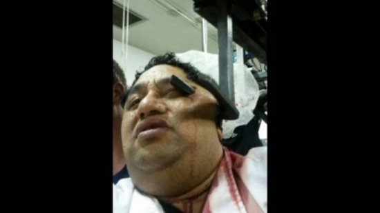 صورة| ظلّ عالقاً بماكينة تقطيع اللحوم..فماذا حدث معه! صورة| ظلّ عالقاً بماكينة تقطيع اللحوم..فماذا حدث معه!