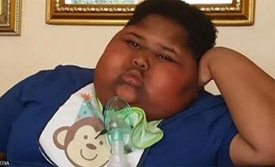 طفل يعاني شهية "استثنائية" ويأكل كل شيء