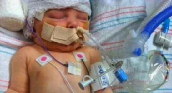 كسر جمجمة ابنه الرضيع لمنعه من البكاء !!