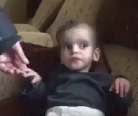 فيديو : طفلة مصابة بالجفاف في مضايا