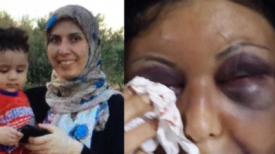 زهراء عن وحشية طليقها: كسر قطعة من السراميك على رأسي