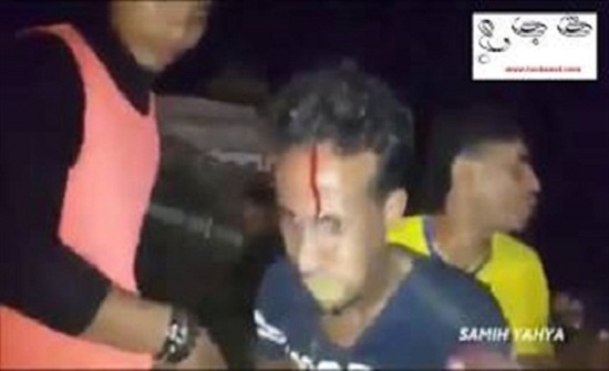 حفل زفاف في اليمن يتحول إلى كارثة (فيديو) حفل زفاف في اليمن يتحول إلى كارثة (فيديو)