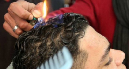 دراسة تكشف عن صفات الرجال المعرضين للصلع المبكر