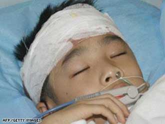 للمرة السابعة مهاجم يقتل ويصيب 27 طفلاً بالصين