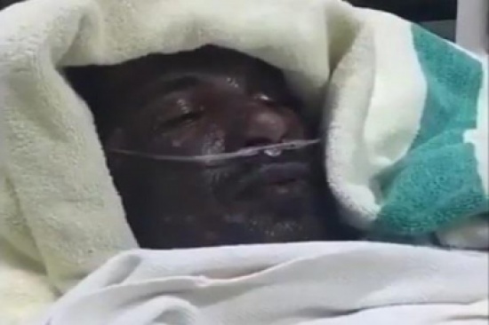 فيديو: سعودي يخاطر بحياته وينقذ 6 أشخاص من حريق ويتعرض لحروق خطيرة فيديو: سعودي يخاطر بحياته وينقذ 6 أشخاص من حريق ويتعرض لحروق خطيرة