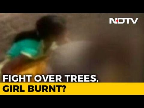 شاهد ..أغرقوها بالبنزين وأضرموا النار بجسدها!