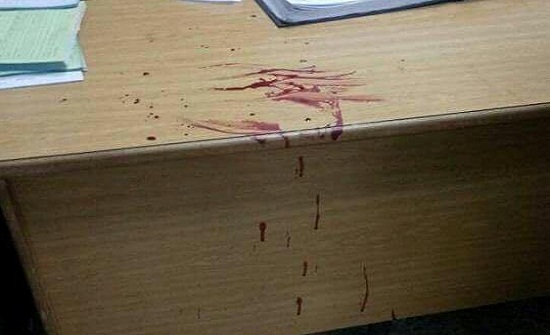 بالصور : مشاجرة دموية داخل مستشفى بإربد