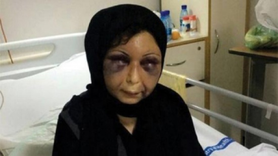 صور مؤلمة جديدة للسورية زهراء بعد خروجها من المستشفى صور مؤلمة جديدة للسورية زهراء بعد خروجها من المستشفى