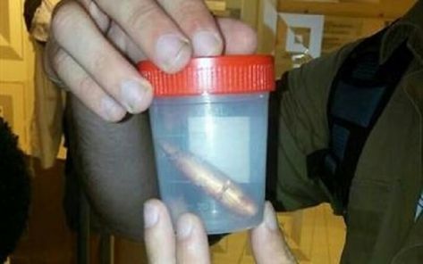 طلقة قناص من غزة تحير الأطباء الإسرائيليين طلقة قناص من غزة تحير الأطباء الإسرائيليين