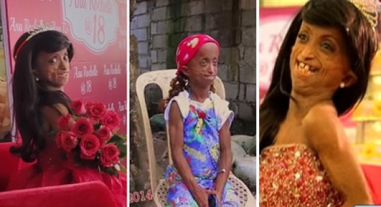 مراهقة فلبينية عمرها 144 عاما تحتفل بعيد ميلادها الثامن عشر مراهقة فلبينية عمرها 144 عاما تحتفل بعيد ميلادها الثامن عشر