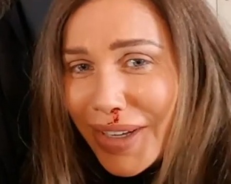بالفيديو- باسم ياخور يضرب نيكول سابا والدم يسيل من أنفها!! ما القصة؟ بالفيديو- باسم ياخور يضرب نيكول سابا والدم يسيل من أنفها!! ما القصة؟