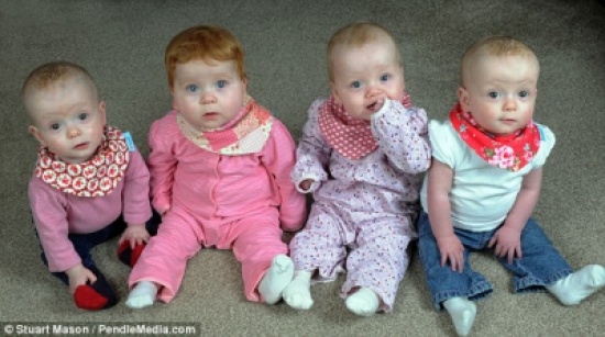 احتماله 1 بالمليونين.. توأم رباعي من تلقيح صناعي " صور "