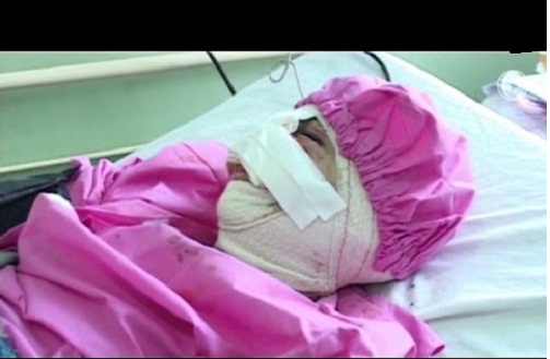 يقطع أنف وشفتي زوجته عقابا لها يقطع أنف وشفتي زوجته عقابا لها