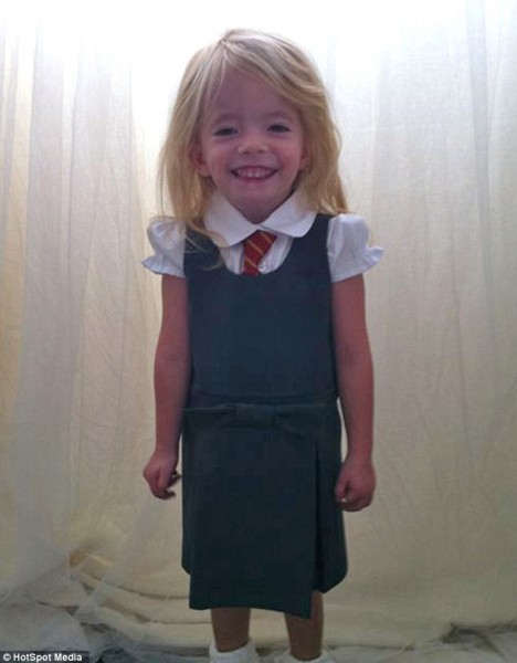 بالصور .. طفلة تعاني من حالة نادرة جدا من التقزم