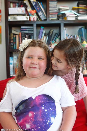 بالصور.. طفلة تصاب بمرض نادر يسبب زيادة وزنها 1 كجم أسبوعيًا