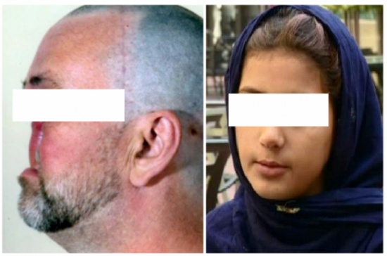 تزوجها دون موافقتهم.. فقطعوا أنفه!