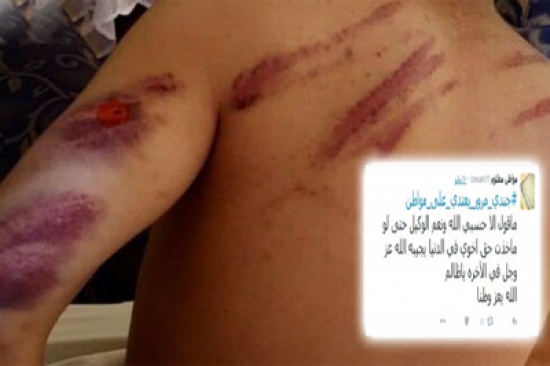 صور: سعودي يتهم رجل مرور بالاعتداء على أخيه.. والمرور يتفاعل سريعاً ويسلمه للشرطة صور: سعودي يتهم رجل مرور بالاعتداء على أخيه.. والمرور يتفاعل سريعاً ويسلمه للشرطة