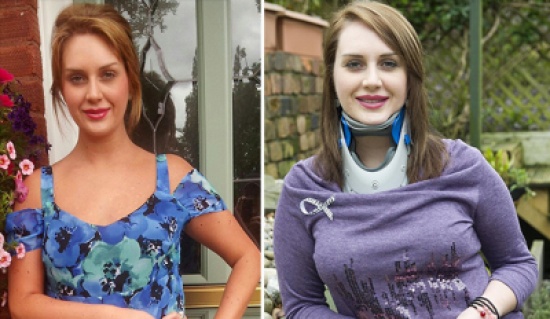 بريطانية تصاب بمرض نادر يتسبب في تقصير طولها !!