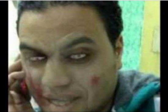 القبض على 'دراكولا' حقيقي وفي بلد عربي!