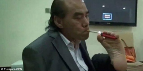 استعاض عن يديه بقدميه !