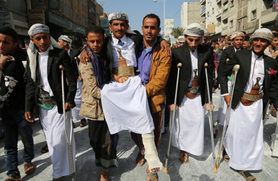 تعز اليمنية تزف 40 عريسا بترت أطرافهم خلال الحرب (شاهد) تعز اليمنية تزف 40 عريسا بترت أطرافهم خلال الحرب (شاهد)