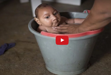 بالفيديو  : معلومات عن فيروس زيكا..!!