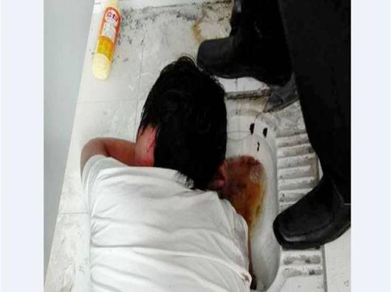 صور| هذا ما حدث ليد الشاب عندما حاول استعادة هاتفه من المرحاض!