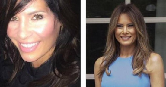 صور| هذه السيدة خضعت لـ6 عمليات في يوم واحد لتشبه ميلانيا ترامب!