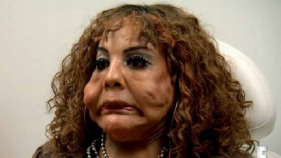 بالفيديو- متحوّلة جنسياً تشعل الانترنت.. حقنوا وجهها بالاسمنت وتسرّب الاطارات.. ستصدمون بشكلها! بالفيديو- متحوّلة جنسياً تشعل الانترنت.. حقنوا وجهها بالاسمنت وتسرّب الاطارات.. ستصدمون بشكلها!