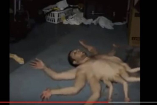 فيديو| رجل جسمه يحتوي على 9 أرجل