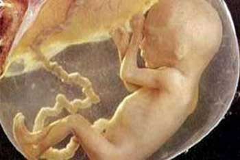 يورانيوم الأسلحة الأمريكية والبريطانية يؤثر على ثلاثة أجيال من أطفال العراق