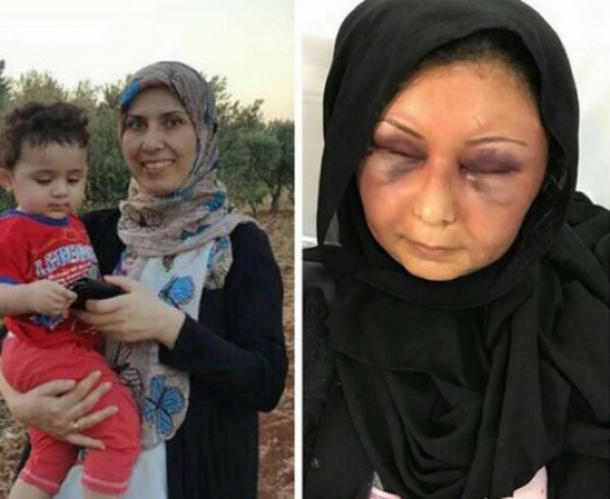 بالصور: مواطن بحريني يضرب زوجته السورية بعنف ويتسبب لها بنزيف في الرأس