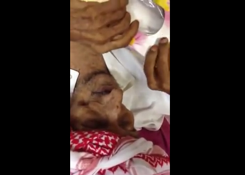 سعودي عمره 137 عاماً في غيبوبة لا يقوم منها إلا للأذان