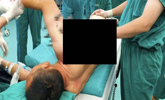 10 قضبان حديدية اخترقت جسده.. هذا ما حصل معه أثناء مناوبة ليلية! 10 قضبان حديدية اخترقت جسده.. هذا ما حصل معه أثناء مناوبة ليلية!