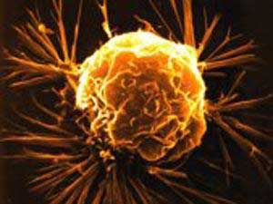  تضاعف معدلات الإصابة بسرطان المريء بين رجال بريطانيا